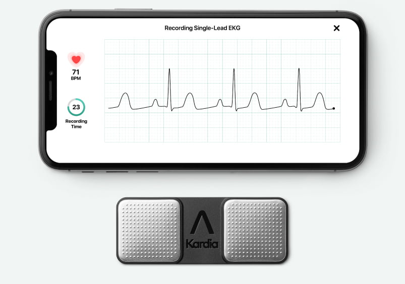 Kardia Mobile paired with an iPhone taking an EKG