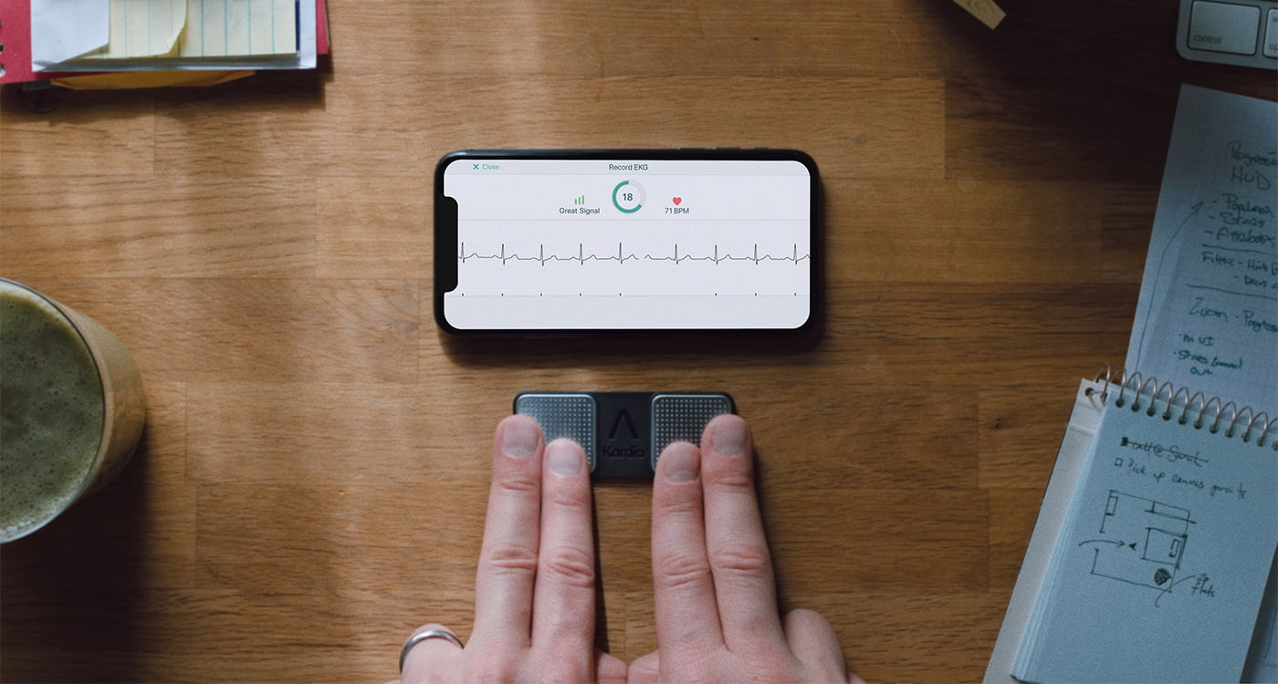 AliveCor KardiaMobile FDA Cleared 1-Lead Personal EKG Monitor