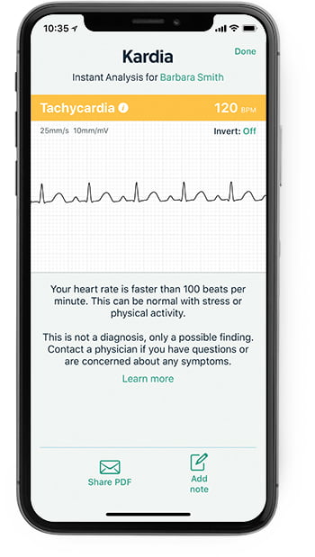 iPhone showing the Kardia app with a tachycardia result